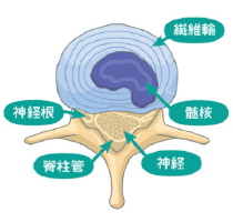 大阪府堺市_テアシス堺鳳整体院_ヘルニア