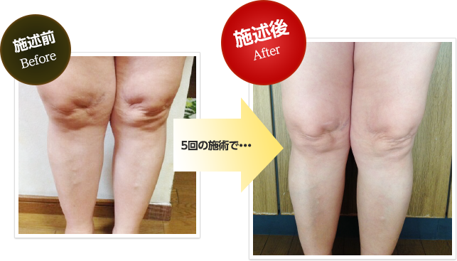 大阪府堺市_テアシス堺鳳整体院_股関節施術変化