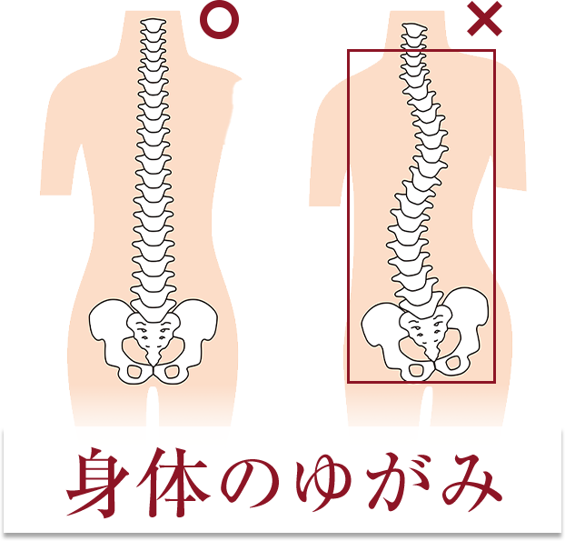 身体のゆがみ