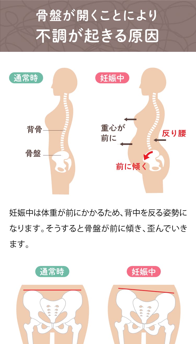 妊娠時は体重が前にかかるため、背中を反る姿勢になります。そうすると骨盤が前に傾き、歪んでいきます。